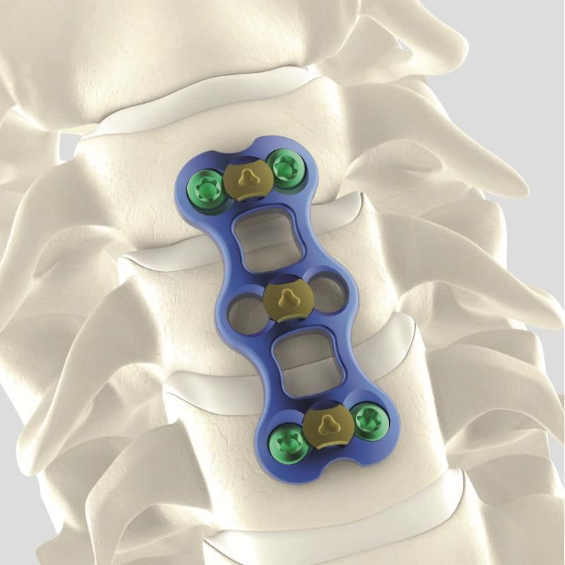Цервікальна (шийна) пластина Cervilock I, 8 отворів WegoOrtho